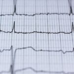 Wat is HRV precies en wat kun je ermee?