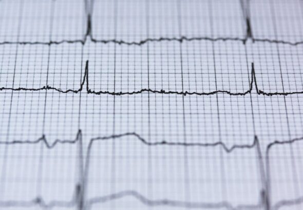 Wat is HRV precies en wat kun je ermee?